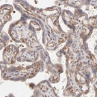Immunohistochemical staining of human placenta shows moderate cytoplasmic positivity in trophoblastic cells.