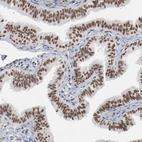 Immunohistochemical staining of human Fallopian tube shows strong nuclear positivity in glandular cells.