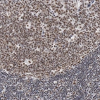 Immunohistochemical staining of human lymph node shows moderate nuclear positivity in germinal center cells.