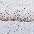Immunohistochemical staining of human cervix, uterine shows strong nuclear positivity in squamous epithelial cells.