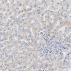 Anti-SERPINA4 Antibody