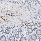 Immunohistochemical staining of human small intestine shows strong positivity in plasma.