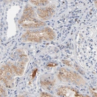 Immunohistochemical staining of human kidney shows strong cytoplasmic positivity in cells in tubules and plasma.