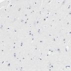 Immunohistochemical staining of human cerebral cortex shows no positivity in neurons as expected.