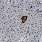 Anti-ZDHHC15 Antibody