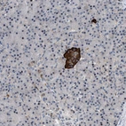 Anti-ZDHHC15 Antibody