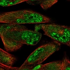 Immunofluorescent staining of human cell line RH-30 shows localization to nuclear speckles & cytosol.