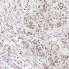Anti-RBM3 Antibody