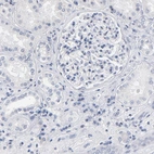 Immunohistochemical staining of human kidney shows no nuclear positivity in cells in glomeruli as expected.