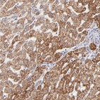 Anti-TIMM8A Antibody