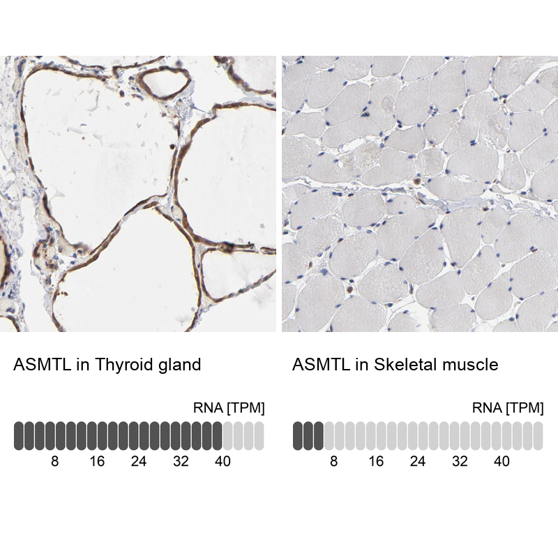 Anti-ASMTL Antibody