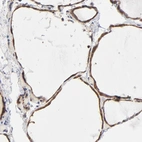 Immunohistochemical staining of human thyroid gland shows high expression.