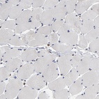 Immunohistochemical staining of human skeletal muscle shows low expression as expected.