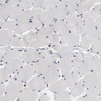 Anti-ASMTL Antibody