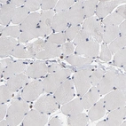 Immunohistochemical staining of human skeletal muscle shows low expression as expected.