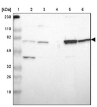 Lane 1: Marker [kDa] 230, 110, 82, 49, 32, 26, 18_br/_Lane 2: Human cell line RT-4_br/_Lane 3: Human cell line U-251MG sp_br/_Lane 4: Human plasma (IgG/HSA depleted)_br/_Lane 5: Human liver tissue_br/_Lane 6: Human tonsil tissue