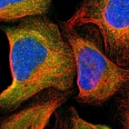 Immunofluorescent staining of human cell line U-2 OS shows localization to cytosol.