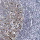 Immunohistochemical staining of human tonsil shows strong membranous positivity in germinal center cells.