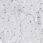 Immunohistochemical staining of human skeletal muscle shows no membranous positivity in myocytes as expected.