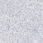 Immunohistochemical staining of human liver shows no membranous positivity in hepatocytes as expected.