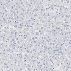 Anti-P2RY8 Antibody