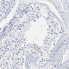Immunohistochemical staining of human testis shows no membranous positivity in cells in seminiferous ducts as expected.