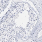 Immunohistochemical staining of human testis shows no membranous positivity in cells in seminiferous ducts as expected.