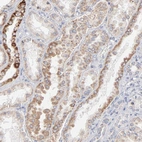 Anti-MRPL58 Antibody