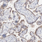Immunohistochemical staining of human placenta shows moderate granular cytoplasmic positivity in trophoblastic cells.