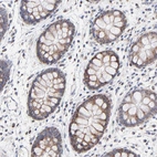 Immunohistochemical staining of human colon shows moderate granular cytoplasmic positivity in glandular cells.