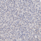 Anti-MRPL58 Antibody