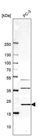Western blot analysis in human cell line PC-3.