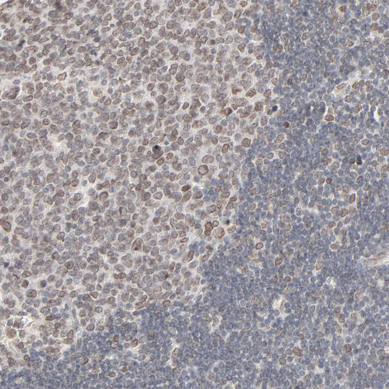 Anti-MAD1L1 Antibody