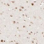 Immunohistochemical staining of human cerebral cortex shows strong positivity in nuclear membrane in neurons and glial cells.