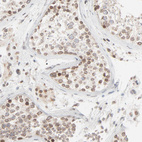 Anti-MAD1L1 Antibody