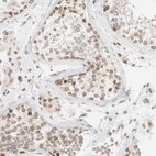 Immunohistochemical staining of human testis shows moderate positivity in nuclear membrane in cells in seminiferous ducts.