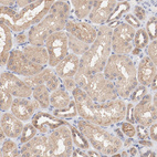 Immunohistochemical staining of human kidney shows moderate cytoplasmic positivity in cells in tubules.