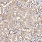 Immunohistochemical staining of human kidney shows moderate cytoplasmic positivity in cells in tubules.