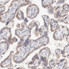 Immunohistochemical staining of human placenta shows moderate cytoplasmic positivity in trophoblastic cells.
