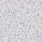 Immunohistochemical staining of human liver shows no expression in hepatocytes as expected.