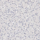 Immunohistochemical staining of human liver shows no expression in hepatocytes as expected.