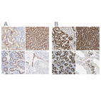 Anti-TST Antibody