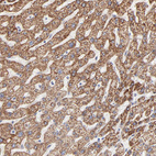 Anti-TST Antibody