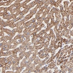 Immunohistochemical staining of human liver shows strong cytoplasm granular positivity in hepatocytes.