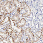 Anti-TST Antibody