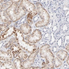 Immunohistochemical staining of human kidney shows moderate cytoplasm granular positivity in cells in proximal tubules.