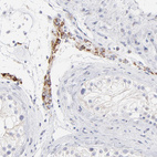 Anti-TST Antibody