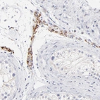 Immunohistochemical staining of human testis shows moderate cytoplasm granular positivity in Leydig cells.