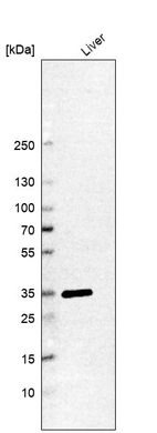 Western blot analysis in human liver tissue.