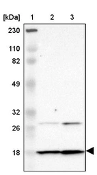Lane 1: Marker [kDa] 230, 110, 82, 49, 32, 26, 18_br/_Lane 2: Human cell line RT-4_br/_Lane 3: Human cell line U-251MG sp